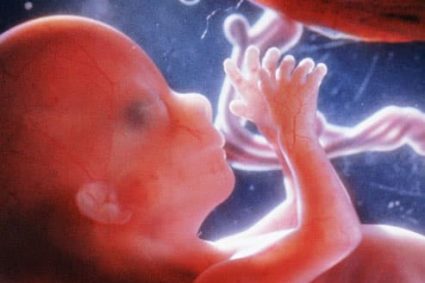 Life begins at Conception & I’m Pro-Choice